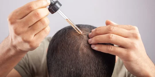 How to Maximize Minoxidil’s Effectiveness for Faster Hair Growth